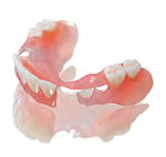 sunflex-bilateral-partial-denture