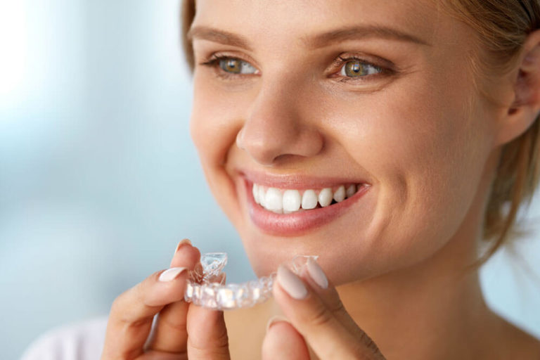 Dental Aligners, Spring Aligners, Ortho Aligner Sun Dental Labs