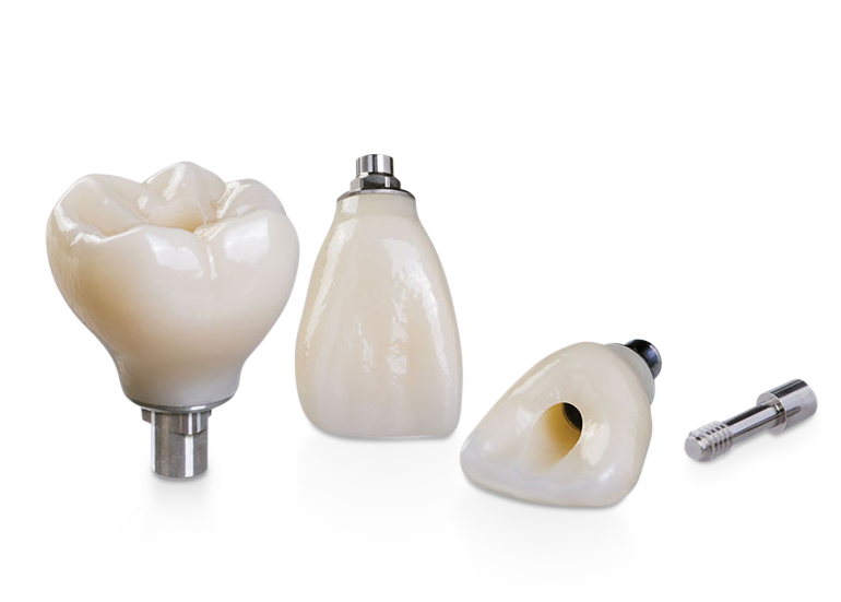 Dental Lab Custom Implants, Verification Jig Implant | Sun Dental Labs