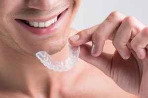 Clear Aligners Miami, FL