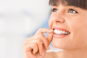 Clear Aligners Jacksonville FL