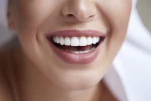 Clear Aligner Fort Lauderdale FL